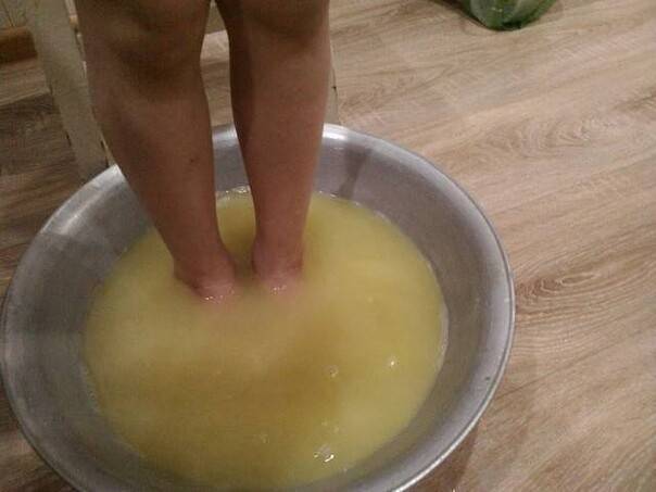 Можно ли парить ноги с горчицей при кашле ребенку